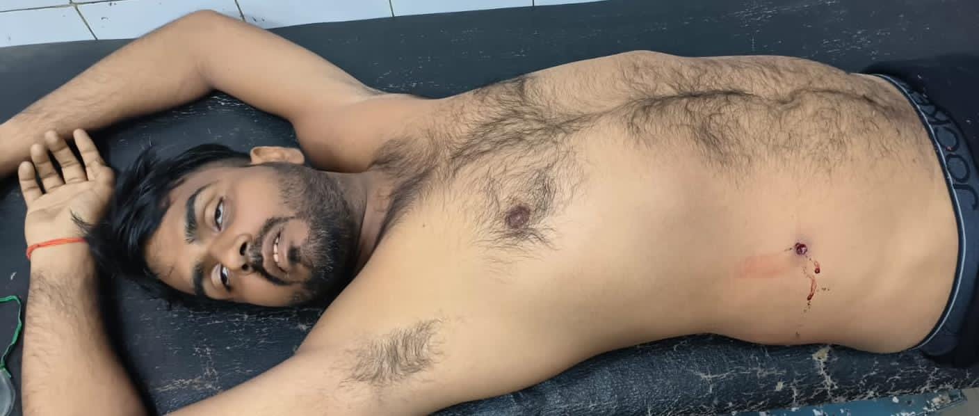 फिर वही घटना, नहीं ले रहे सबक,हर्ष फायरिंग के दौरान युवक को लगी गोली।